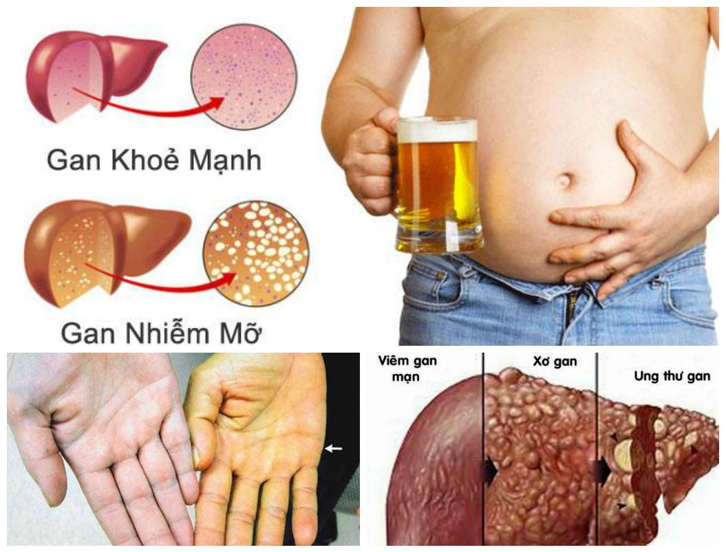 C:\Users\Hai\Desktop\triệu đức hòa\gan\FotorCreated.jpg