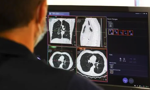 Vaccine kéo dài sự sống của bệnh nhân ung thư não ác tính