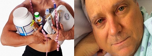  Dùng thực phẩm bổ sung tùy tiện có thể gây nguy hiểm cho thận, gan