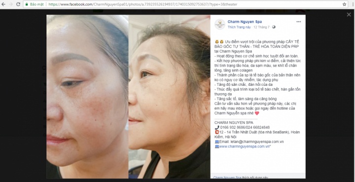 Charm Nguyễn Spa11.jpg